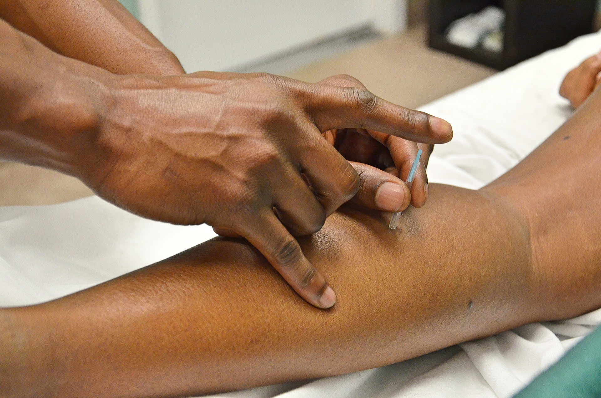 dry needling procedure being done on an arm
